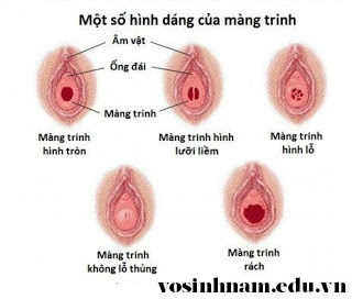 Hình ảnh màng trinh con gái rõ nét nhất