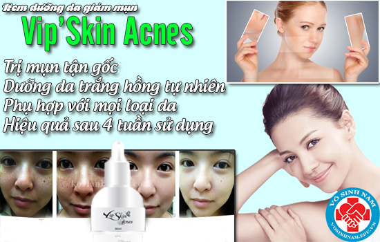 Vip’Skin Acnes ,Kem dưỡng da giảm mụn Vip’Skin Acnes