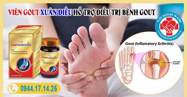 Viên gout Xuân Điều