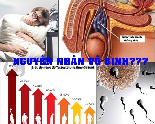 nguyên nhân vô sinh ở nam giới